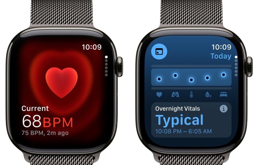 Odkryj Apple Watch 10 z mediolańską bransoletą: oszczędź 1500 zł na tym technologiczny majstersztyku