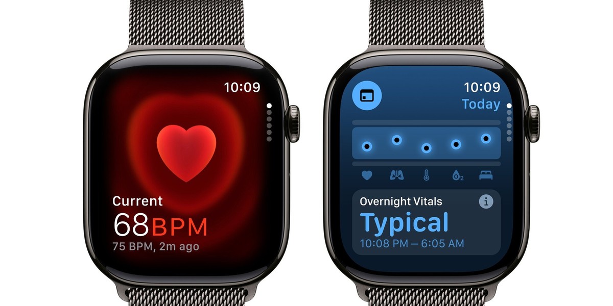 Odkryj Apple Watch 10 z mediolańską bransoletą: oszczędź 1500 zł na tym technologiczny majstersztyku 2 Apple Watch 10 z bransoletą mediolańską: kupisz to cudo o 1,5 tys zł taniej